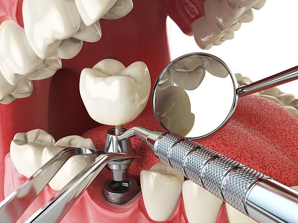 Best Emergency Dental Services for Seniors in Jarrell, TX